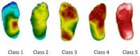 Projeto | Automatic Classification of Foot Thermograms